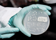 INFECȚIILE DIN SPITALE, O BOALĂ GREA