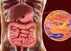 BACTERIA CARE POATE DUCE LA CANCER DE STOMAC